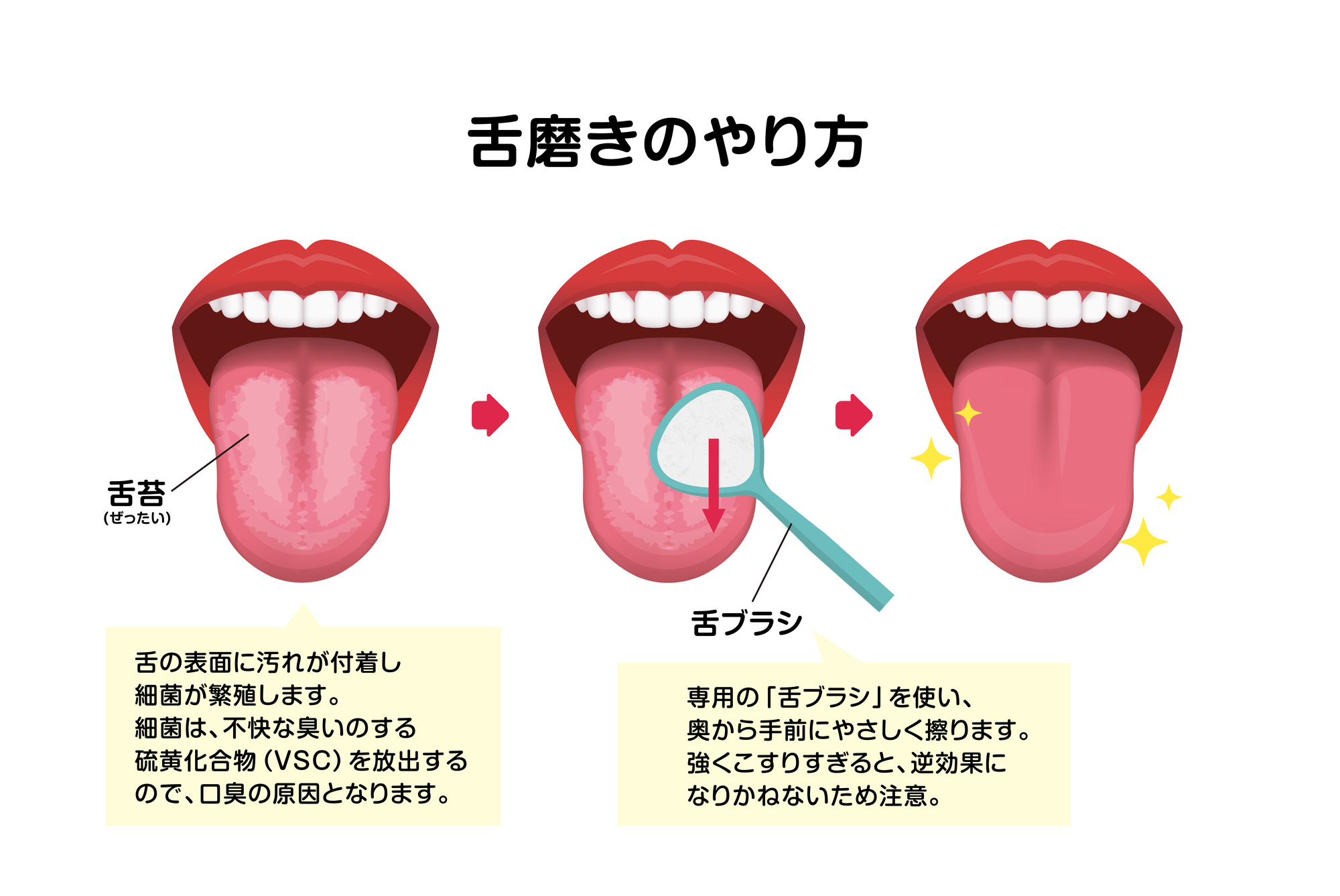 舌が荒れる原因: 舌が切れて痛い 直し方 – EXYB