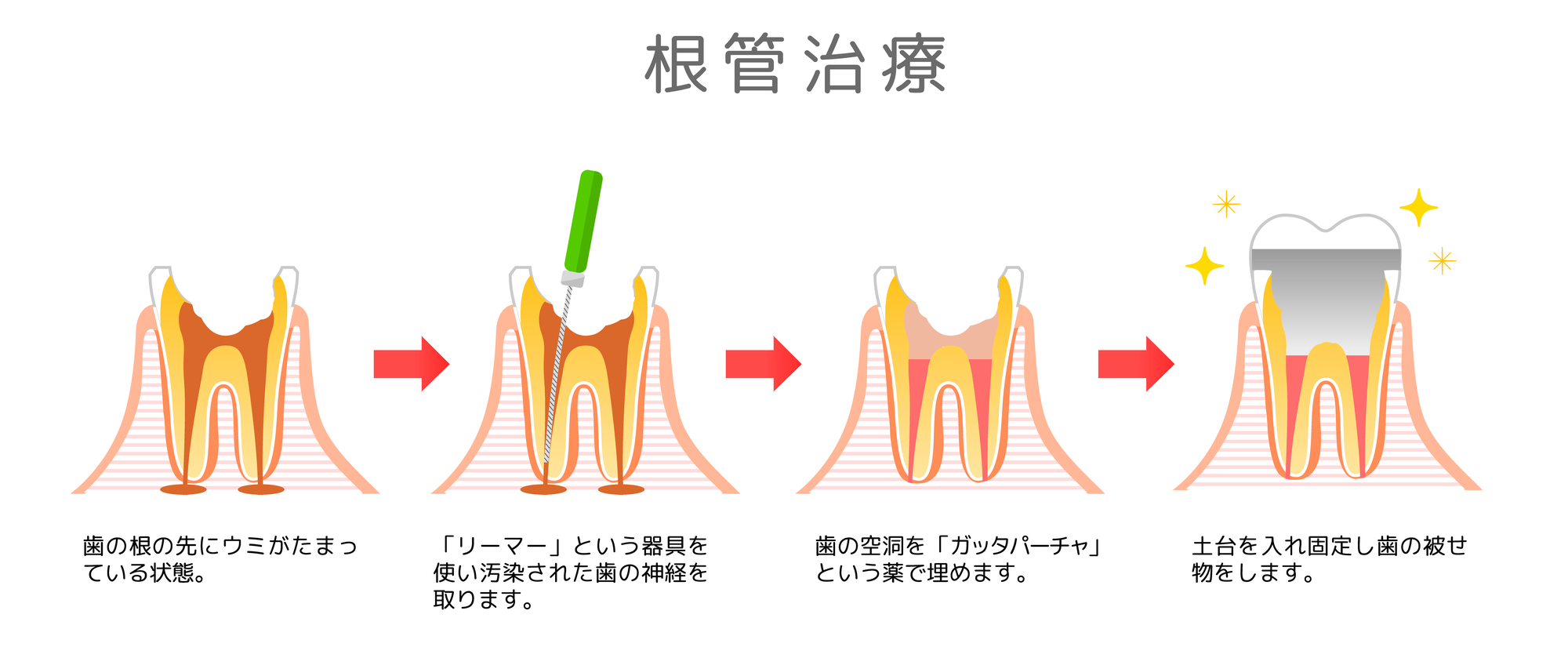 歯を抜いた後、鏡を見られますか？